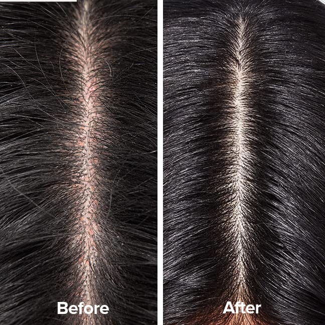 Scalp Therapy Shampoo L558006
