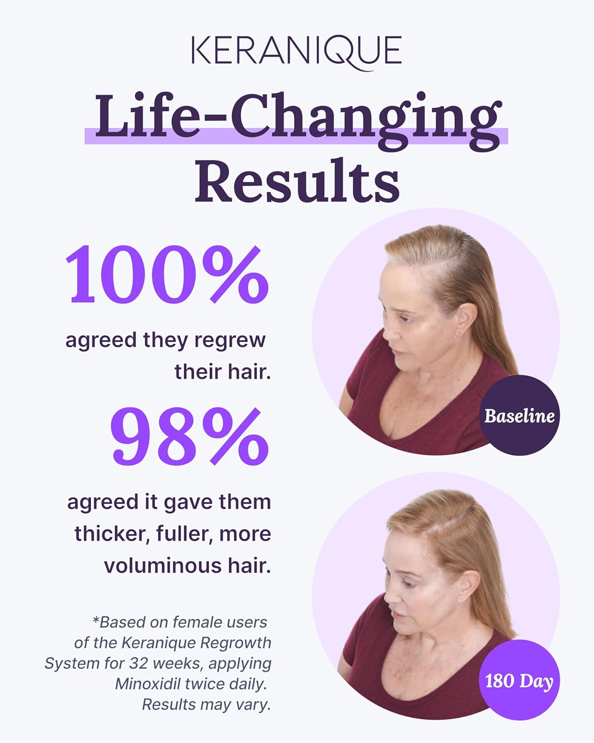 2% Minoxidil Hair Regrowth Tonic for Women G294